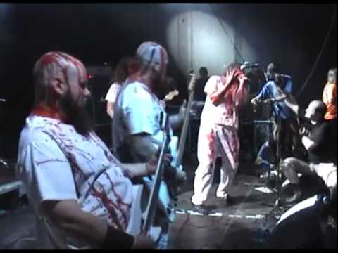 GENERAL SURGERY Live at OEF 2010