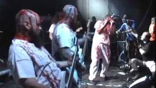 GENERAL SURGERY Live at OEF 2010