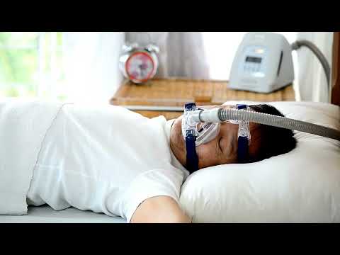 Treating Obstructive Sleep Apnea With Inspire Therapy