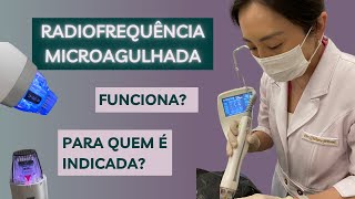 Radiofrequência Microagulhada Funciona? Tudo Que Você Precisa Saber!