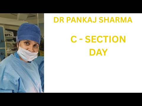 C-Section Day — What to Expect