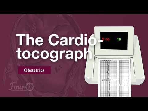 Understanding CTG in Labour: How to Read a Cardiotocograph