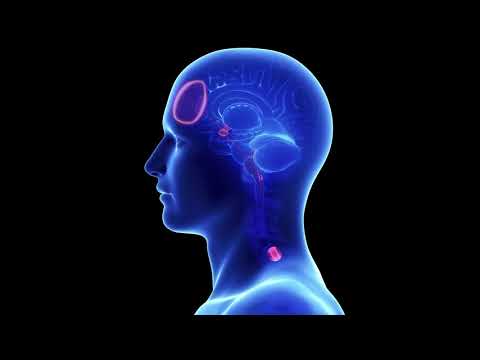 The Bridge Device NSS-2 addiction Treatment Opiate detox without Withdrawal