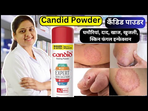 Candid Powder - Candid Dusting Powder - Clotrimazole Dusting Powder - Candy Powder - Dusting Powder