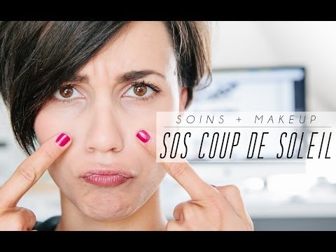 comment soulager un coup de soleil sur le visage