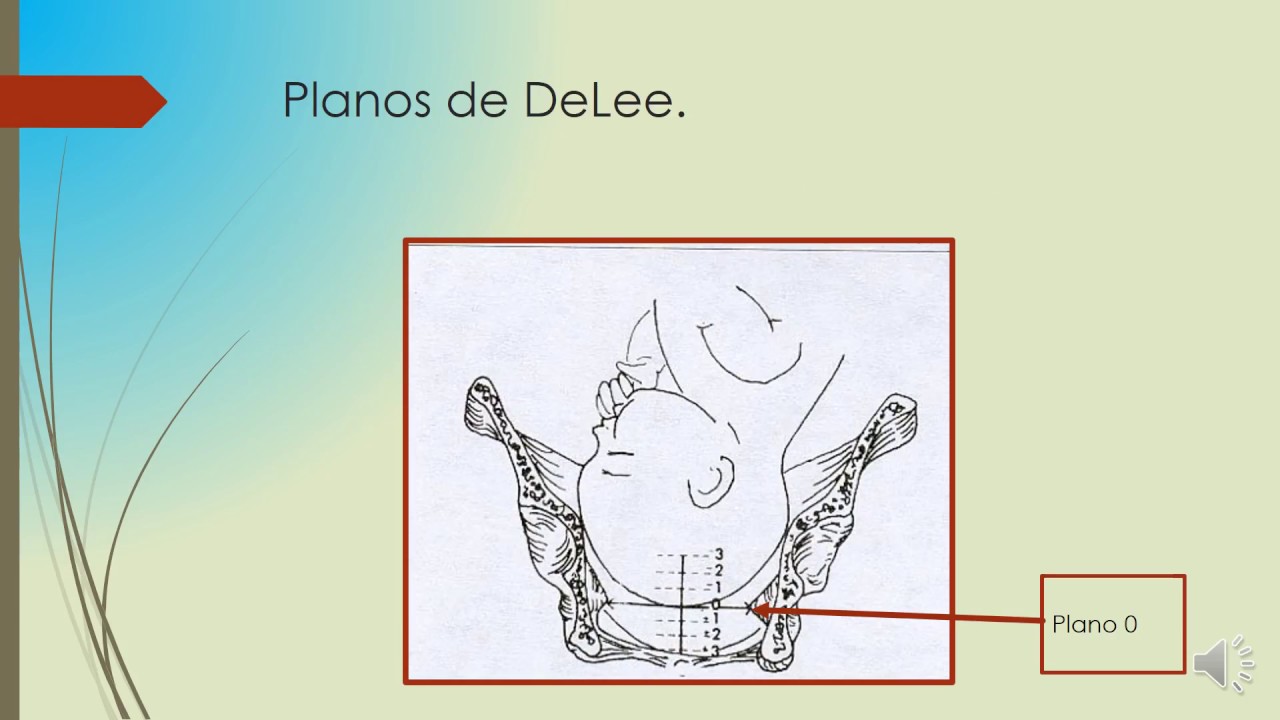 Planos de De Lee no trabalho de parto1. #oencaixefetal.