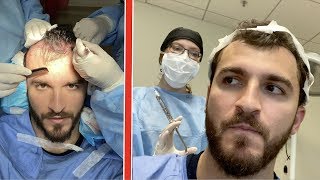 My Hair Transplant Surgery Changed My Life