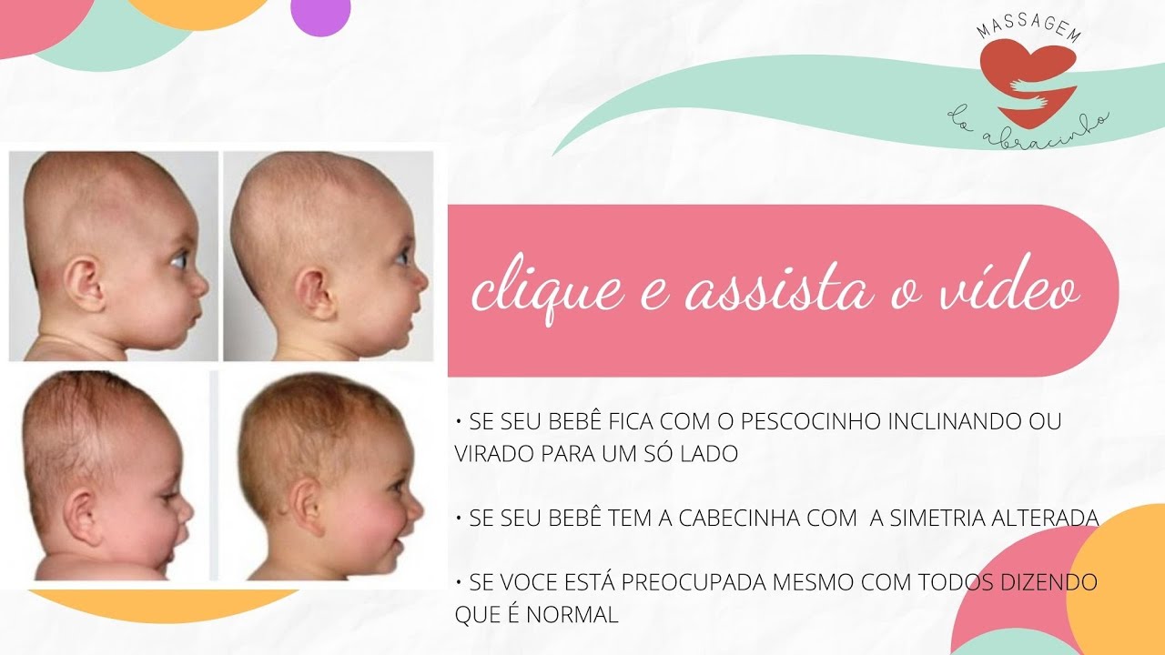 Meu trabalho é intervir na assimetria craniana  thumbnail