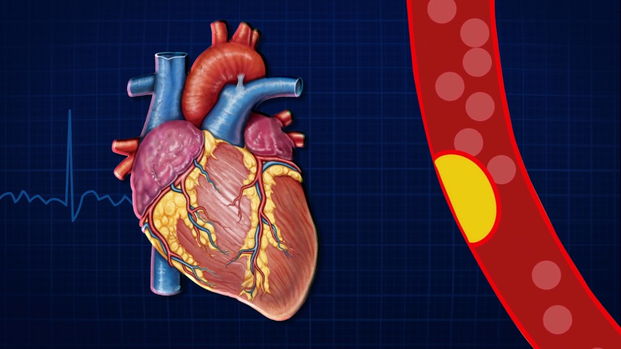 Fernando Bernardi-14