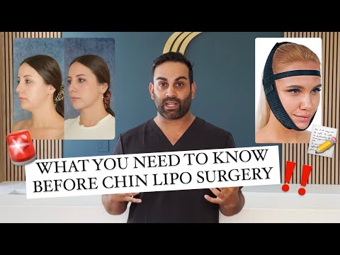 5 Things You NEED To Know Before Getting Chin Lipo