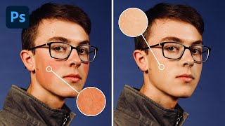 How to Remove Redness from Skin in Photoshop
