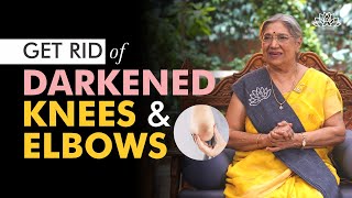 How To Lighten Your Knees, Elbows and Armpits with this 5 Natural Home Remedies | Natural Skin Tips