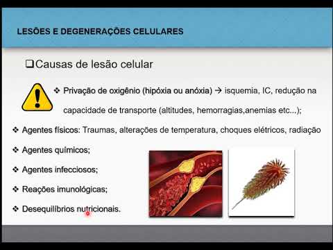 Degenerações 1 - Patologia Geral
