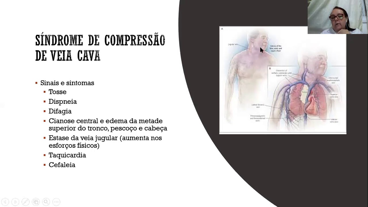 Emergências Oncológicas