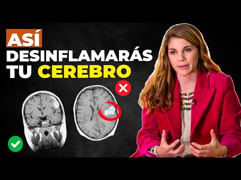 ¿Por Qué Deberías Preocuparte por la Neuroinflamación? Causas, Síntomas y Tratamientos[Marian Rojas]