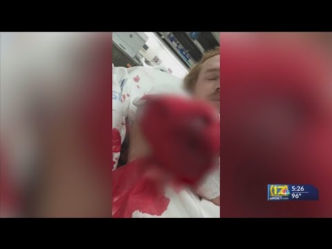 'He survived, but barely': Father of ax attack victim searches for assailants