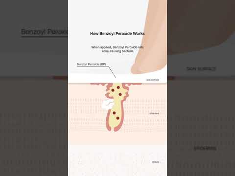 Benzoyl peroxidp soap ncne c, 2.5%