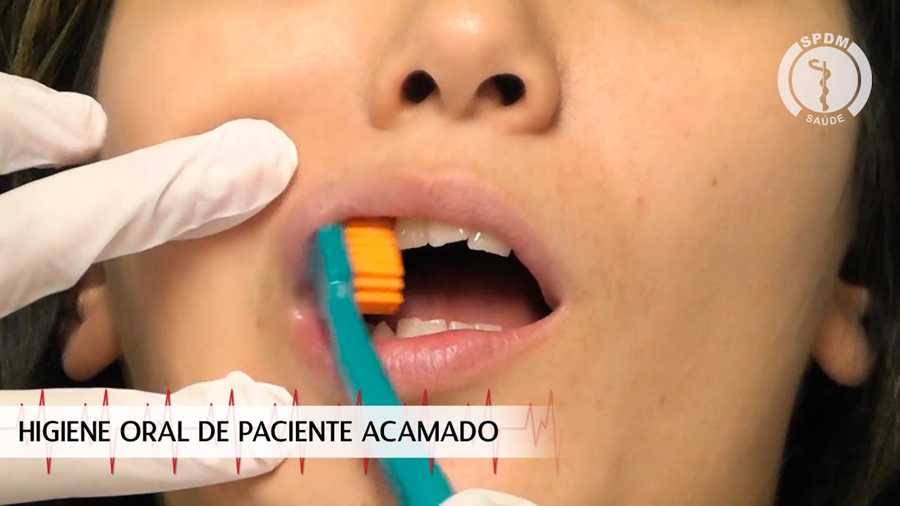 Higiene Oral do Paciente Acamado