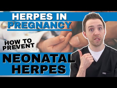 Genital Herpes Simplex Virus In Pregnancy (HSV) (Neonatal Herpes Simplex Infection)