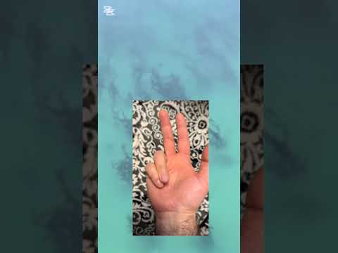 Si të bëjm dhikrin ( tesbiht ) me gishtrinjë ?