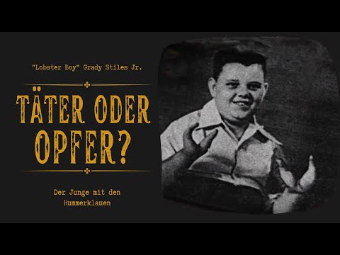 Der Junge mit den Hummerklauen - Grady Stiles Jr. (Lobster Boy Doku deutsch)