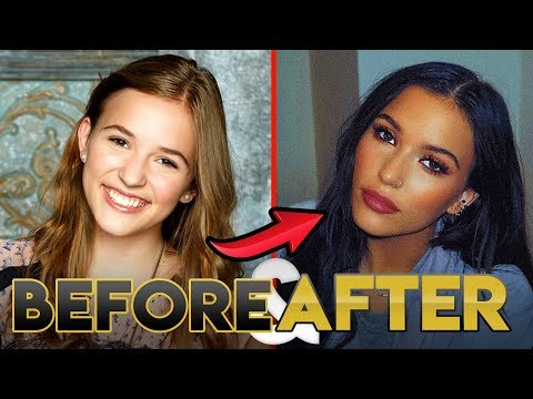 Lennon Stella Glow Up 2019 | Before and After Transformations ( Lips, Hair, Diet & More )