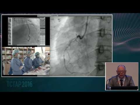 [CTO Live 2016] Live Case Session I