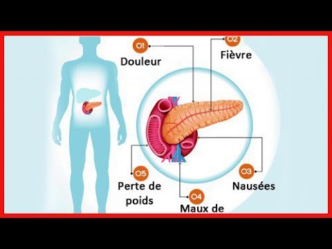Le pancréas et ses problèmes : 6 symptômes