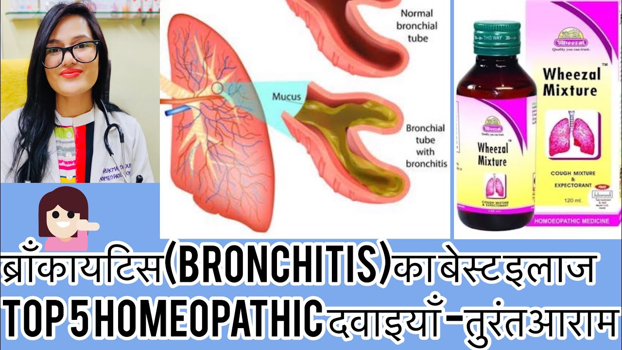 ब्रॉंकायटिस Bronchitis Homeopathic treatment-medicine for bronchitis-Dr.rukmani homeopathic Clinic