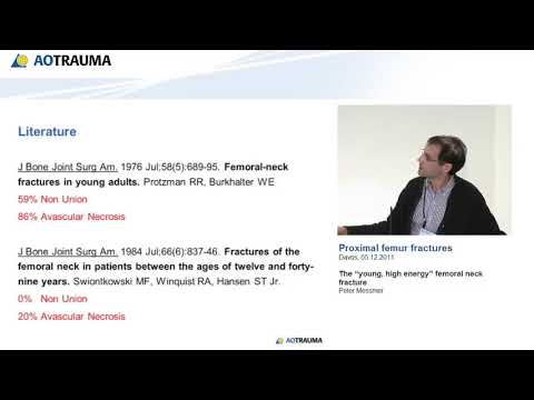 Proximal Femoral Fractures—The “young, high energy” femoral neck fracture
