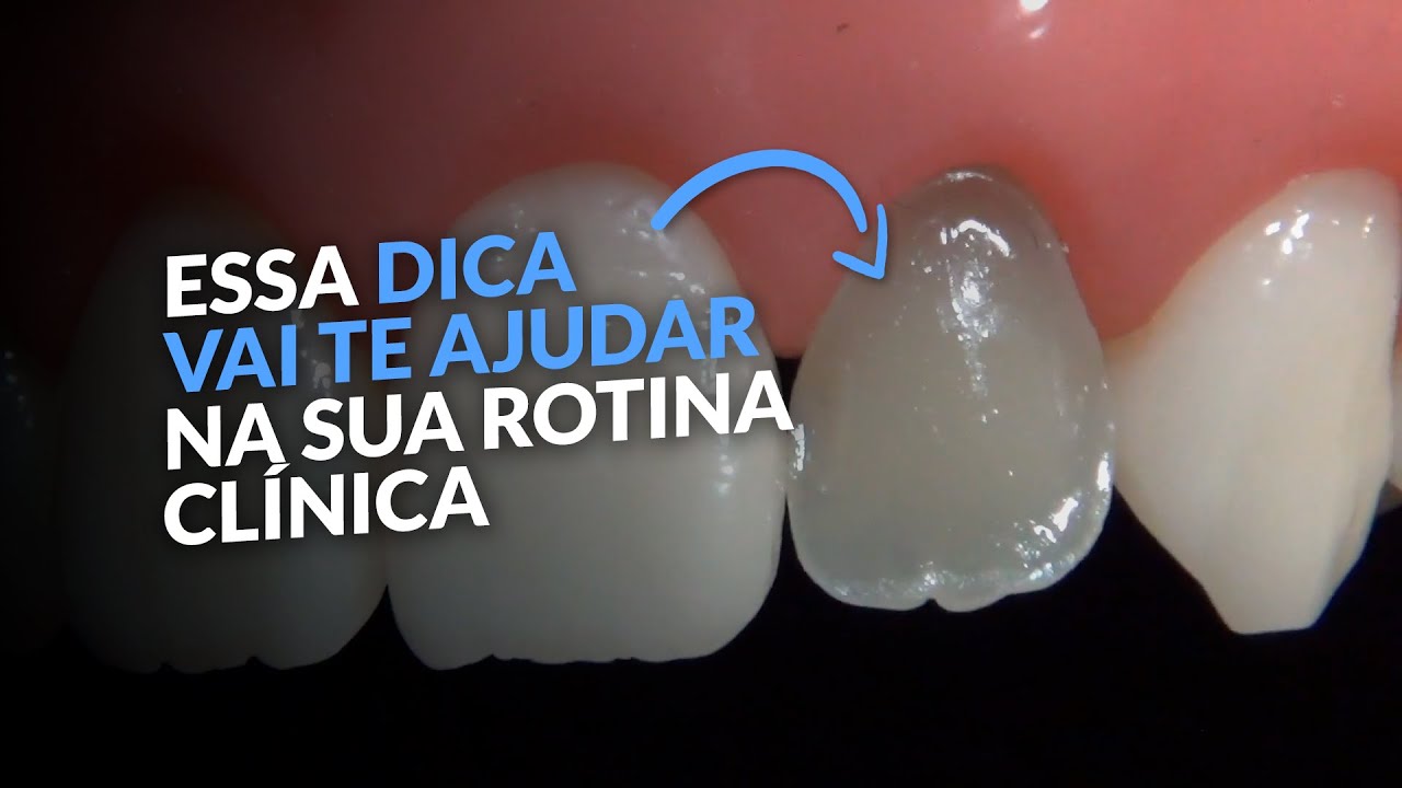 COMO TRATAR DENTES ESCURECIDOS