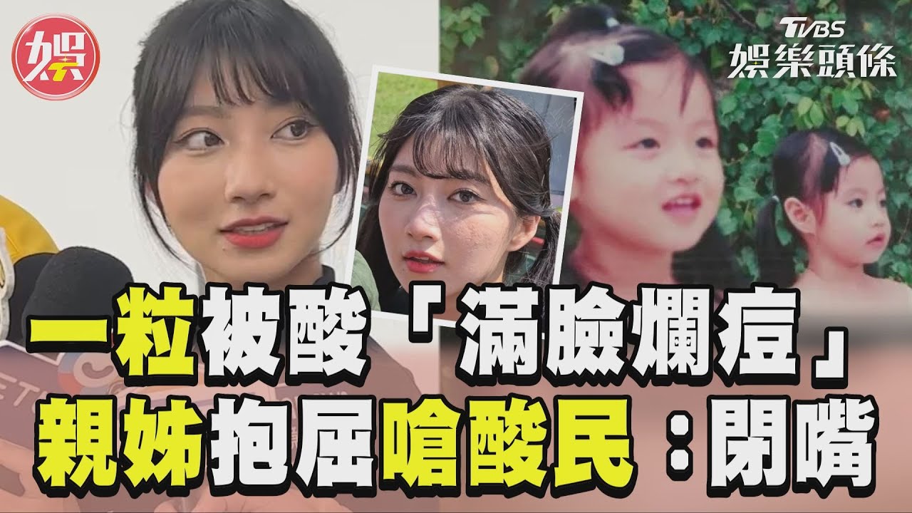 影音/一粒被酸「滿臉爛痘」 親姊抱屈嗆酸民:閉嘴