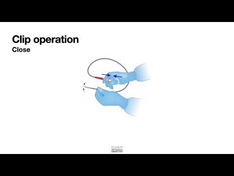 HCC 1472 -Lesson-11a1-Hemostatic Devices   Through the Scope Clips movie