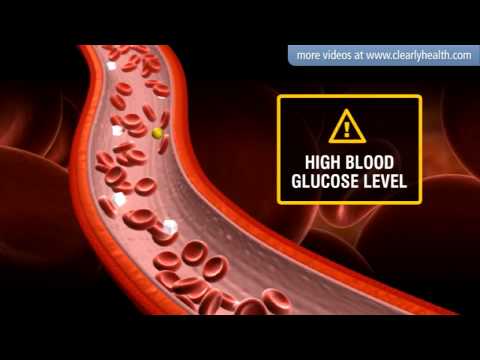Getreide für Diabetes Frauen mellitus Bewertungen