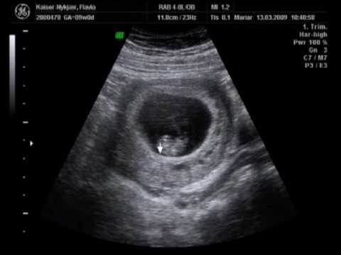 Mini Kaiser Scanning 20090313