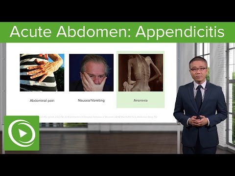 Acute Abdomen: Appendicitis – General Surgery | Lecturio