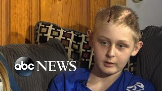 Miraculous recovery for 13-year-old declared brain dead