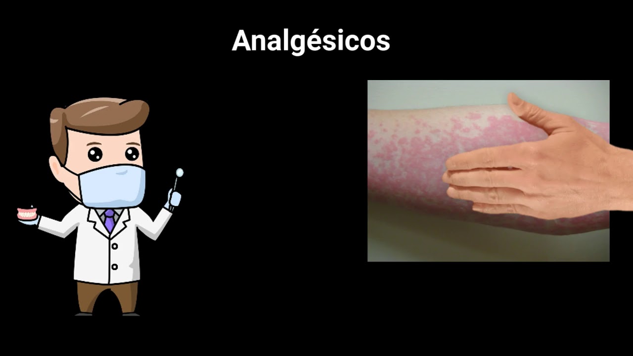 Watch REACCIONES ALÉRGICAS EN ODONTOLOGÍA Now REACCIONES ALÉRGICAS EN ODONTOLOGÍA