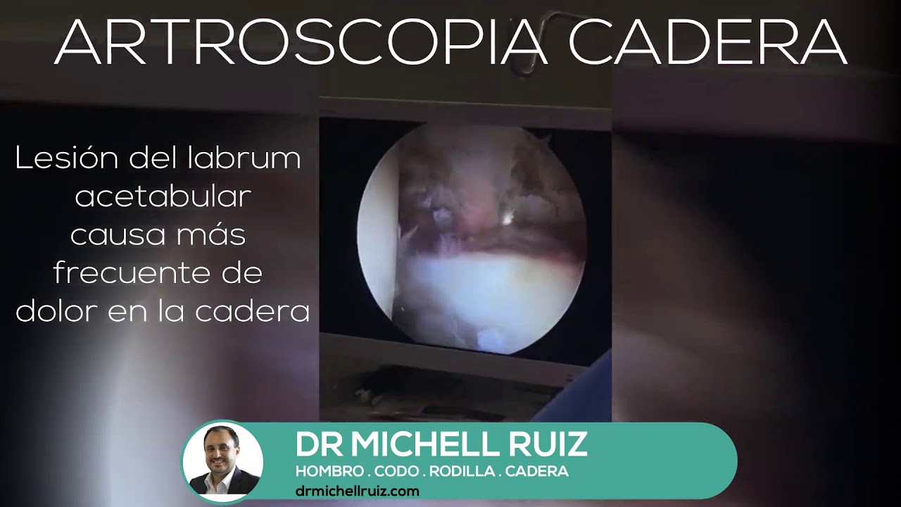 Michell Ruiz Suárez-8