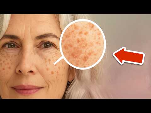 A deficiency of this mineral causes age spots💥(HERE'S HOW YOU CAN FIX IT)🤯