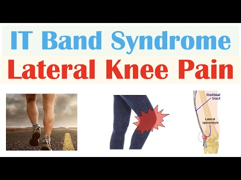 Sjogren s Syndrome Dry Eye Syndrome Primary vs Secondary Symptoms Diagnosis and Treatment