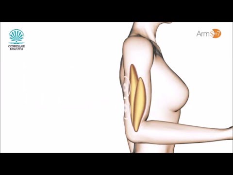 Миостимулятор для рук Slendertone, женский