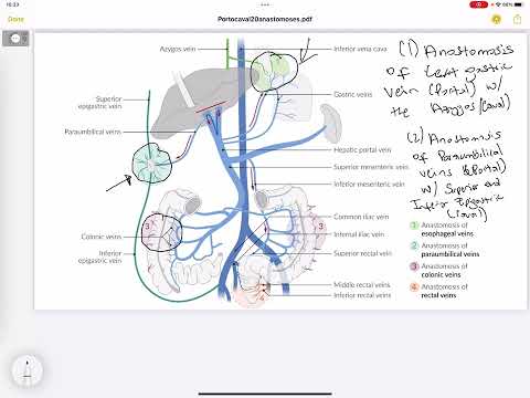 Portocaval Anastomoses