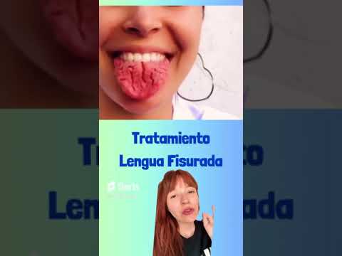 Tratamientos de la Lengua Fisurada