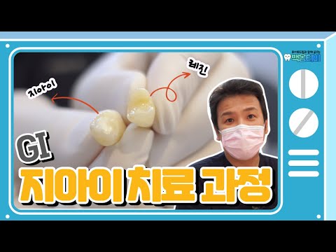 당신이 눈감은 사이.....지아이(GI) 치료 과정 보여드릴게요 / 레진vs지아이 비교