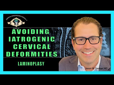 Avoiding Iatrogenic Cervical Deformities - Laminoplasty