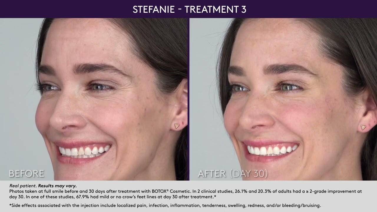 Victoria Med Spa From 159 San Gabriel Groupon