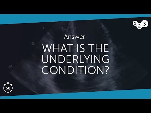 60 Seconds of Echo Teaching Answer: What is the underlying condition?