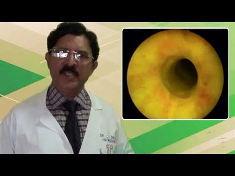  Direct Vision Internal Urethrotomy - Reaching up to the stricture