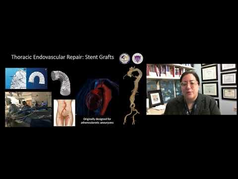 2020 Virtual Summer Conference: (أنواع المضاعفات وكيفية التحقق منها (لم يؤكد بعد | Arabic (ARB)
